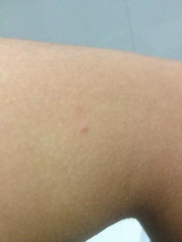 内膜上长了几个小肉肉精子过不去(精子遇到卵子什么感觉)