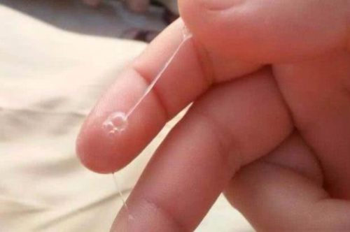 卵细胞会不会排出体外(女生的卵细胞会不会流出来）