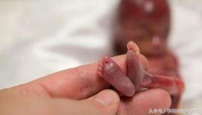 人工流产后多久可以怀孕人流后能马上要孩子吗?(打掉孩子还能怀上的几率)