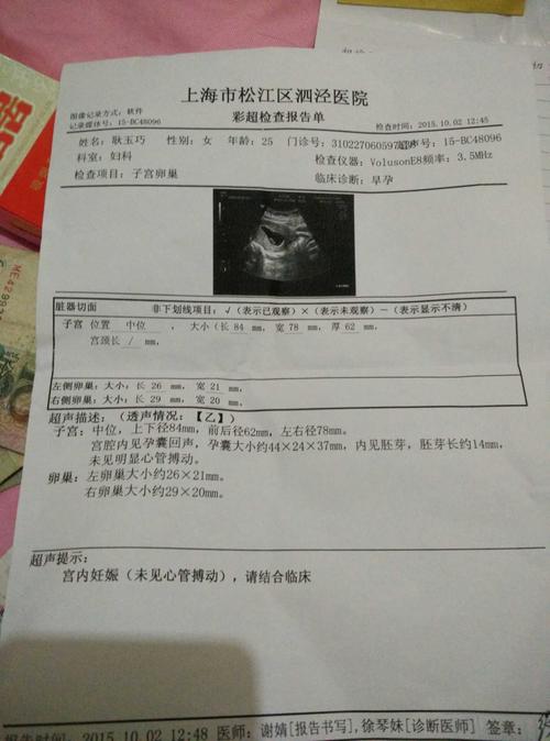 卵子质量不好会导致胎停吗(造成胎停育的六大原因）