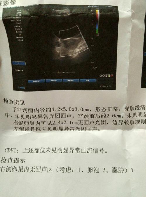 右侧附件囊肿是什么原因造成的(右侧附件囊肿怎么引起的）