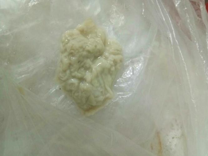 分泌物像豆腐渣是怎么回事(下面很痒还有像豆腐渣什么原因)
