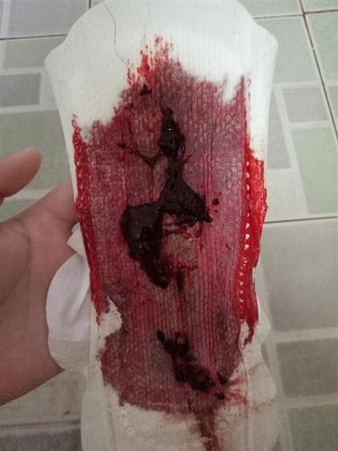 计划怀孕之前，这些常见的备孕问题，或许能够帮到你(备孕计划半年计划书）