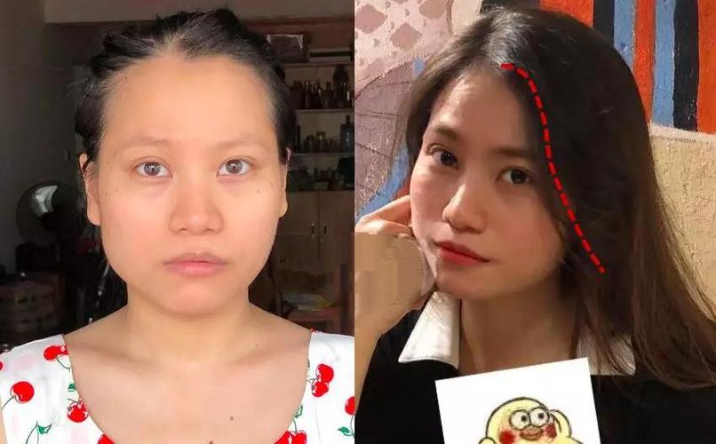 卵泡发育偏小的原因(卵泡小的原因有哪些）