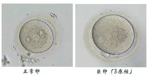 冷冻卵子几大误区(卵子直径大约为多少)
