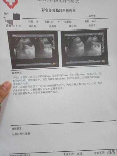 右附件囊肿有什么危害(右侧附件囊肿55x47cm怎么办）