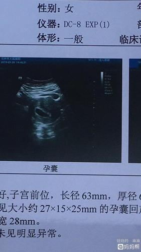 同房25天孕囊多大(同房23天孕囊多大）