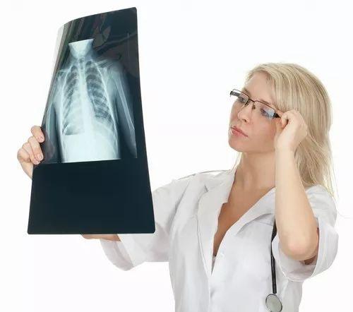 老公拍胸片影响备孕吗(怀孕做胸透怎么补救）