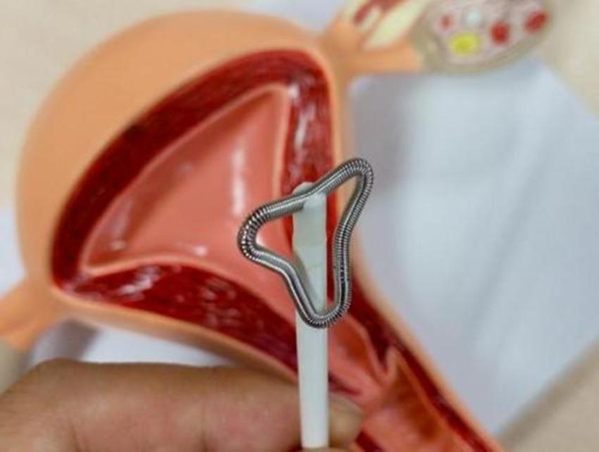 避孕套和上环哪个安全呢(上环还要带避孕套吗）