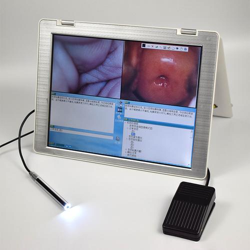 什么情况下需要做阴道镜检查?(妇科检查里阴镜检查疼吗)