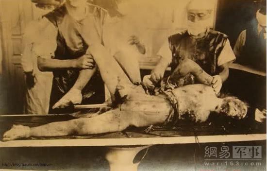 人体试验合法吗(现在还有人体实验吗）