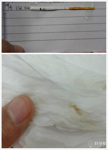 褐色分泌物怎么回事(女性流出咖啡色分泌物是怎么回事）