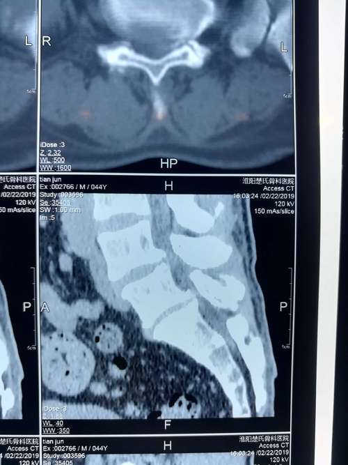 同房后出现小腹痛影响怀孕吗(女性同房后腰酸小腹痛）