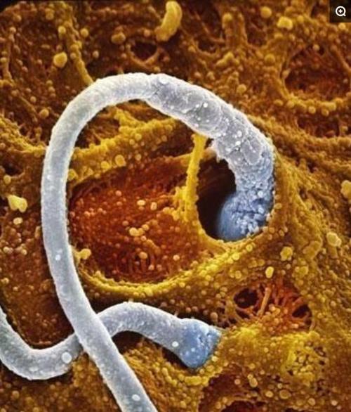 卵子和卵子可以结合生小孩吗(找卵子生小孩）