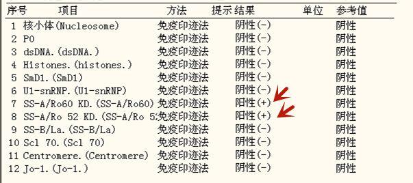 免疫抗体检查有啥作用(自身抗体免疫检查什么）