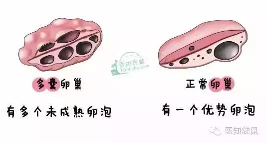 卵泡长不大是什么原因？该怎么办？(卵泡总是长不大）