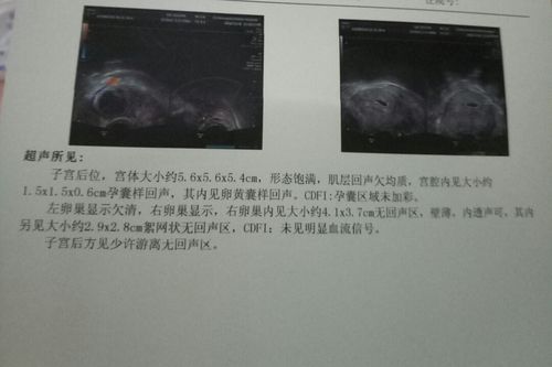 同房28天孕囊0(同房后28天还看不到孕囊怎么回事）