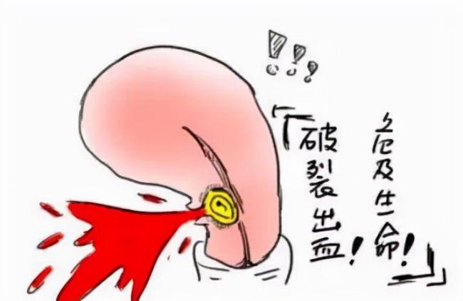 人工授精还是试管疼(试管婴儿取卵时疼吗）