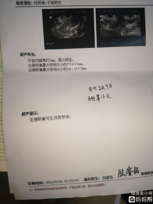 卵泡一直不破会怀孕吗(卵泡25x22医生说没希望了）