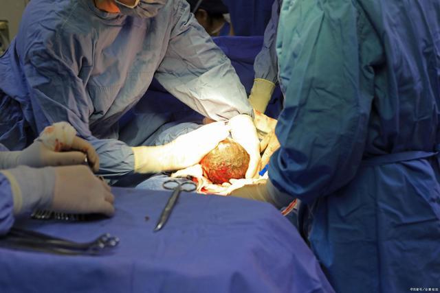 剖腹产后多久可以怀孕(剖宫产1年又怀孕了)