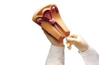 人流后可以放避孕环吗(流产后可不可以同时上环）