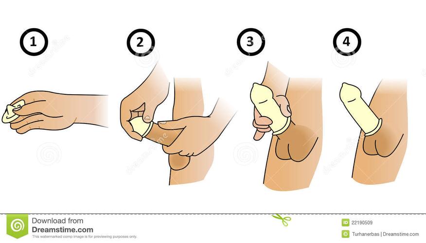 避孕套扎洞怎么扎得准(安全套怎么正确使用）