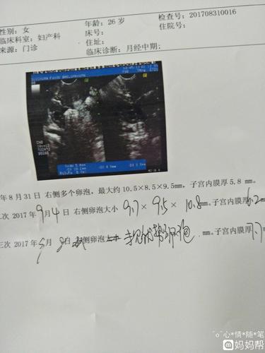 卵泡长不大一般是什么原因(7个症状暗示卵巢早衰）