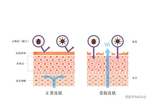 低聚果糖对皮肤有哪些危害(低聚果糖不适合哪些人喝）