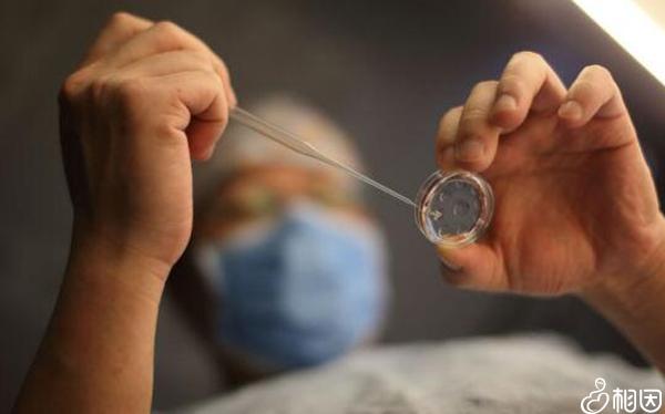 人工受孕都需要些什么?(人工受孕的大概费用)