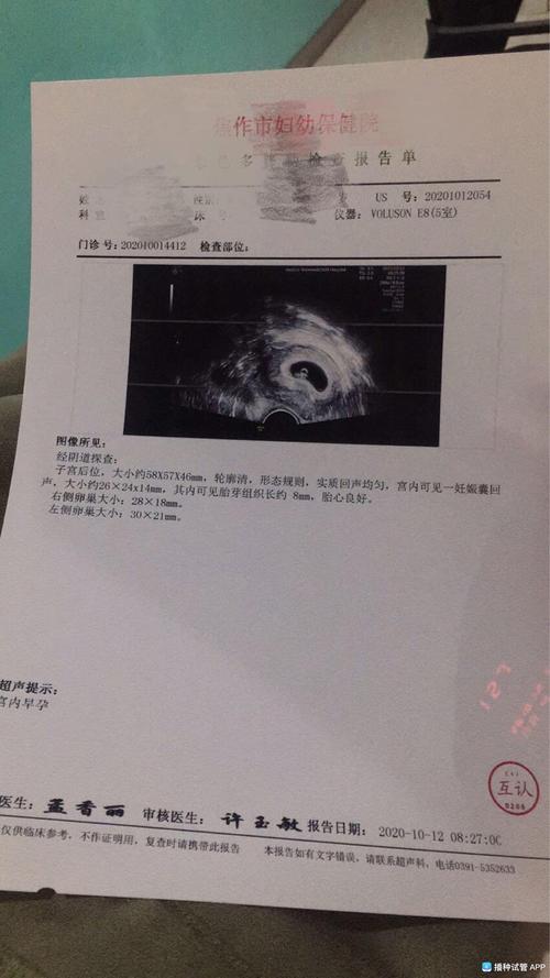 同房30天孕囊多大(同房即受孕20天孕囊有多大）