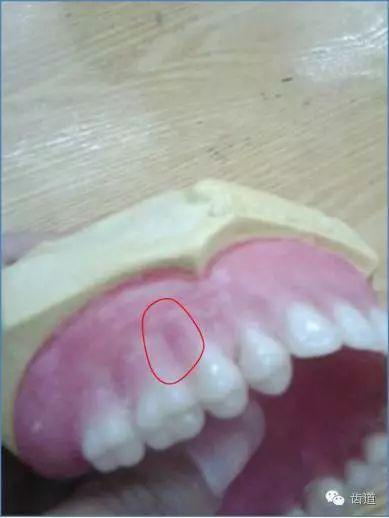 避孕套啥样咋用(避孕套怎么使用）