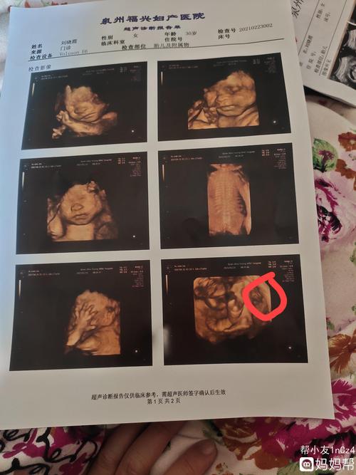 医生说怀男孩的暗语(四维看男孩女孩诀窍）