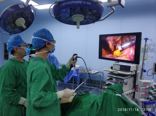 为什么剖腹产后不孕了(宫腹腔镜手术通输卵管多少钱）