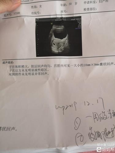 刚刚怀孕排卵试纸是阴性吗(刚怀孕的排卵试纸图片）