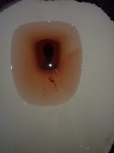 为什么经期血是黑色的这几个病因一定要注意!(经期同房了怎么办啊)