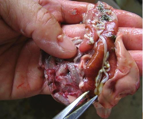 功血可以怀孕吗(无排卵型功血）