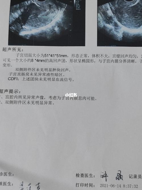 内膜息肉1(子宫内膜息肉1公分严重吗)