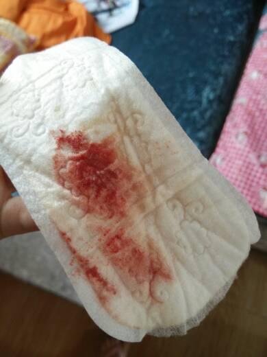 产后十八天恶露还有血块正常吗(产后恶露干净了又有血了怎么回事）