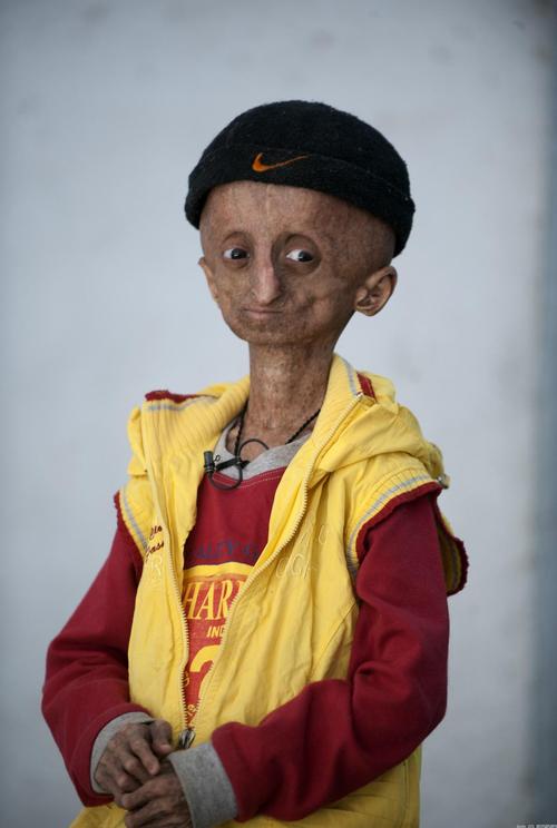 卵巢功能衰退能生育吗(三十多岁卵巢早衰怎么办）