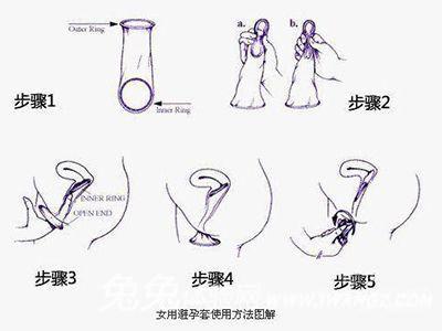 避孕套使用方法有哪几步(正确使用安全套的方法）