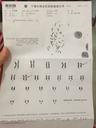 哪些人需要做染色体检查(做染色体检查是抽血吗)