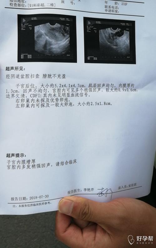 吃促排药怀孕几率多大(促排三次卵泡排了没有怀孕)