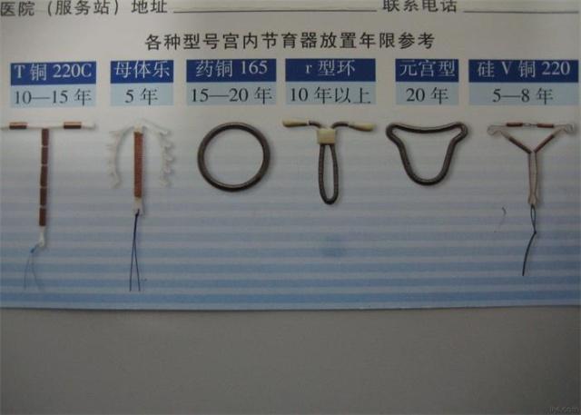 取环后最快多久可以怀孕取环后能马上怀孕吗？(同房了还能取环吗）