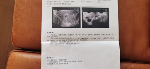 同房28天孕囊多大正常(受孕28天孕囊有多大）