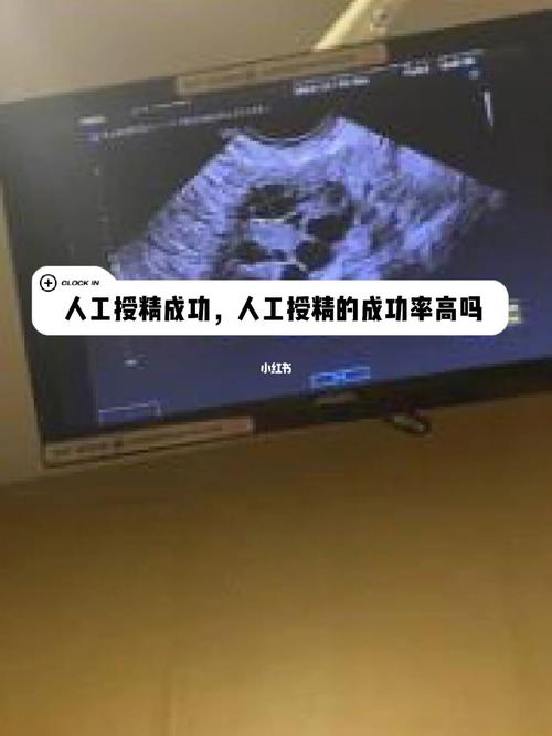 什么样的夫妻适合人工授精人工授精的孩子正常吗(男女都正常做人工授精成功率多少）