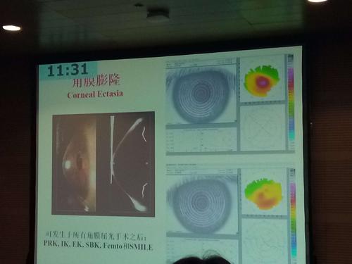 卵子小能受孕吗(卵子17能成功受孕)