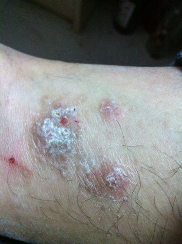 产后45天同房会怀孕吗(怀孕初期下面有什么变化）