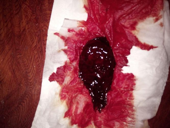 同房八天了有什么症状(排卵七八天有什么症状）