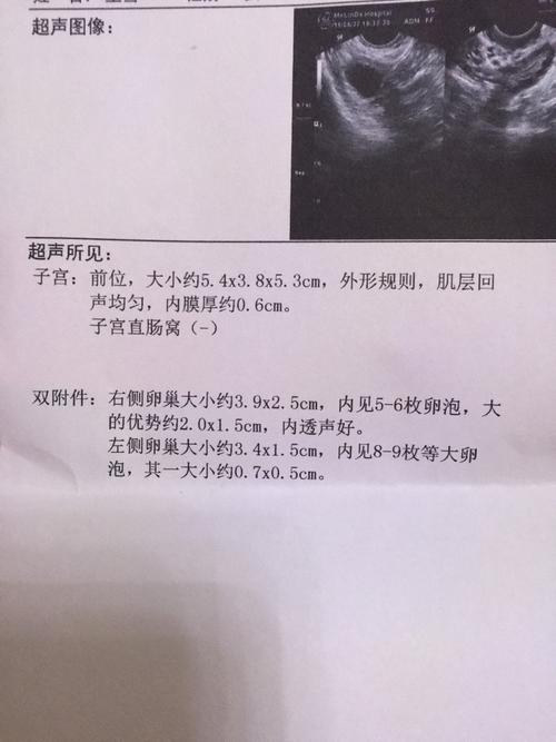 卵泡破裂同房几次最好(卵泡破当天最明显的症状)