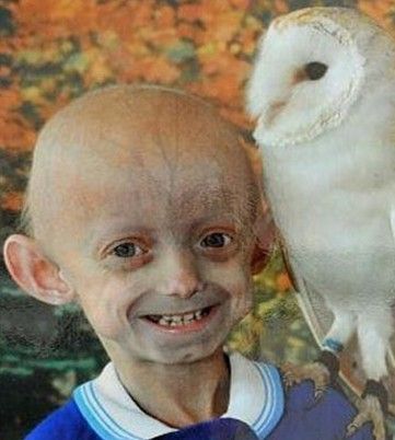 卵巢早衰的女人可以怀孕吗(卵巢早衰影响怀孕的吗）